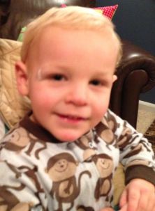 Proudly displaying his bandaged gash!